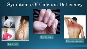 Hypocalcemia: What are The Causes and Symptoms of Calcium Deficiency?